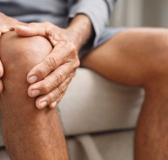 knee osteoarthritis treatment